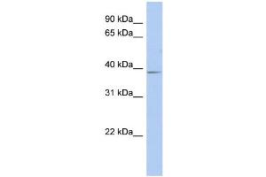 WB Suggested Anti-SLC25A28 Antibody Titration:  0. (SLC25A28 Antikörper  (Middle Region))