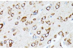 Immunohistochemistry of paraffin-embedded Rat brain using RPL7 Polyclonal Antibody at dilution of 1:100 (40x lens). (RPL7 Antikörper)
