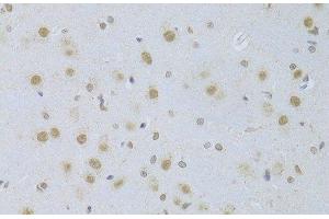 Immunohistochemistry of paraffin-embedded Rat brain using CDKN1A Polyclonal Antibody at dilution of 1:100 (40x lens). (p21 Antikörper)