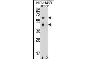 Western blot analysis of PREF3 Antibody (C-term) Pab (ABIN656587 and ABIN2845849) pre-incubated without(lane 1) and with(lane 2) blocking peptide in NCI- cell line lysate. (PRAMEF3 Antikörper  (C-Term))