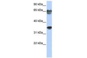 Image no. 1 for anti-NK3 Homeobox 2 (NKX3-2) (N-Term) antibody (ABIN6740332) (NKX3-2 Antikörper  (N-Term))