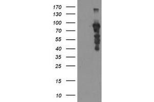Western Blotting (WB) image for anti-SRY (Sex Determining Region Y)-Box 5 (SOX5) antibody (ABIN1501083) (SOX5 Antikörper)