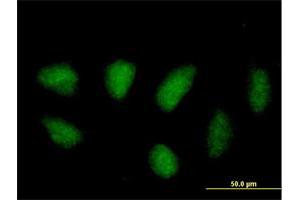 Immunofluorescence of purified MaxPab antibody to MAPK11 on HeLa cell.