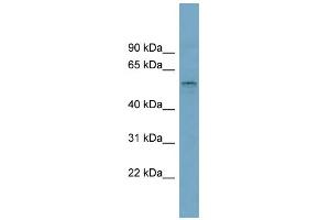 WB Suggested Anti-SLC22A15 Antibody Titration:  0. (SLC22A15 Antikörper  (Middle Region))