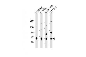 All lanes : Anti-NOX4 Antibody (N-term) at 1:2000 dilution Lane 1: Human kidney lysate Lane 2: HUVEC whole cell lysate Lane 3: U-251 MG whole cell lysate Lane 4: U-87 MG whole cell lysate Lysates/proteins at 20 μg per lane. (NADPH Oxidase 4 Antikörper  (N-Term))