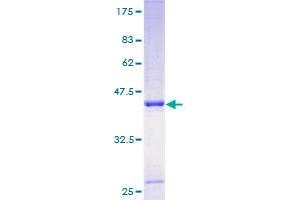 Image no. 1 for TIMP Metallopeptidase Inhibitor 1 (TIMP1) (AA 1-169) protein (GST tag) (ABIN1322788)