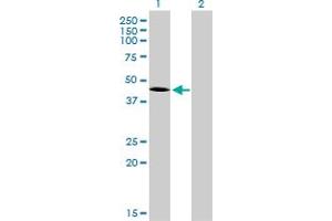 Western Blot analysis of T expression in transfected 293T cell line by T monoclonal antibody (M01), clone 5H8. (T Brachyury Protein (AA 222-320) Antikörper)