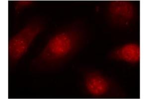 Image no. 3 for anti-Retinoblastoma 1 (RB1) (pSer780) antibody (ABIN196842) (Retinoblastoma 1 Antikörper  (pSer780))
