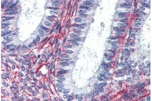 Immunohistochemistry (IHC) image for anti-Angiotensin II Receptor, Type 2 (AGTR2) (Internal Region) antibody (ABIN1048323)