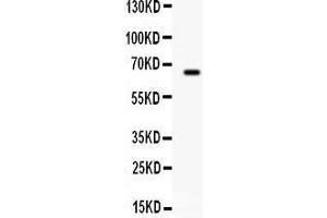 Observed bind size: 66KD (Butyrylcholinesterase Antikörper  (AA 263-571))