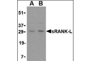 Western blot analysis of sRANK-L in rat liver tissue lysate with this product at (A) 0.