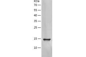 Chemokine (C-C Motif) Ligand 2 (CCL2) (AA 24-99) (Active) protein (His tag)