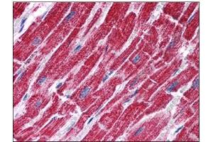 Human Heart: Formalin-Fixed, Paraffin-Embedded (FFPE) (FH Antikörper  (Internal Region))