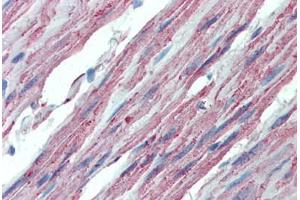 Anti-ITGA3 / CD49c antibody  ABIN1048975 IHC staining of human colon.