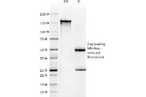 SDS-PAGE Analysis Purified HLA-A Mouse Monoclonal Antibody (108-2C5). (HLA-A Antikörper)