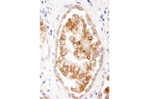 Immunohistochemistry (IHC) image for anti-ATP-Binding Cassette, Sub-Family B (MDR/TAP), Member 9 (ABCB9) (AA 475-525) antibody (ABIN7454799)