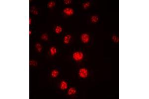 Immunofluorescent analysis of CDC16 staining in HeLa cells. (CDC16 Antikörper  (C-Term))