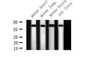 Western blot analysis of ILKAP expression in various lysates (ILKAP Antikörper  (N-Term))