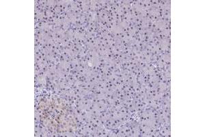 Immunohistochemical staining of human pancreas with C3orf26 polyclonal antibody  shows moderate nucleolar positivity in exocrine glandular cells at 1:200-1:500 dilution.