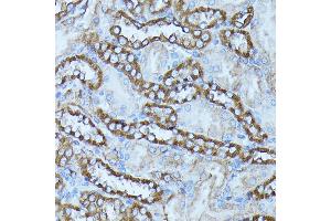 Immunohistochemistry of paraffin-embedded rat kidney using FGD1 antibody (ABIN7267284) at dilution of 1:100 (40x lens). (FGD1 Antikörper  (AA 700-800))