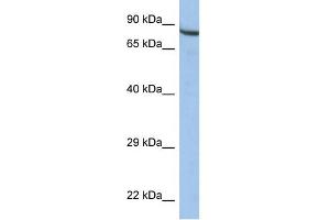 WB Suggested Anti-ZNF630 Antibody Titration:  0.