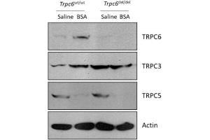 Immunoblot analysis showing abundance of TRPC family channels in renal cortex of wild type(wt) andTrpc6del/del rats.
