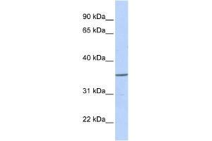 WB Suggested Anti-ZNF688 Antibody Titration:  0. (ZNF688 Antikörper  (Middle Region))