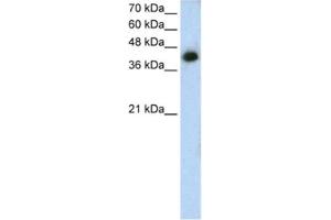 Western Blotting (WB) image for anti-Microtubule Associated Tumor Suppressor 1 (MTUS1) antibody (ABIN2462816) (MTUS1 Antikörper)