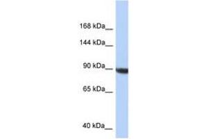 Image no. 1 for anti-KIAA1549 (KIAA1549) (C-Term) antibody (ABIN6747731)