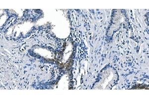 IHC analysis of ASS1 using anti-ASS1 antibody (ABIN7601192). (ASS1 Antikörper  (AA 3-365))
