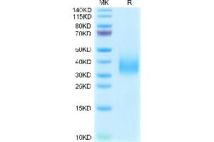 TREM2 Protein (AA 19-174) (His tag)