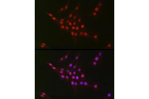 Immunofluorescence (IF) image for anti-C-terminal Binding Protein 2 (CTBP2) antibody (ABIN7265979)