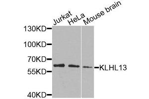 Western blot analysis of extracts of various cell lines, using KLHL13 antibody (ABIN6003698) at 1/1000 dilution. (KLHL13 Antikörper)