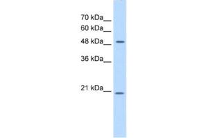 Western Blotting (WB) image for anti-Glucosaminyl (N-Acetyl) Transferase 4, Core 2 (Beta-1,6-N-Acetylglucosaminyltransferase) (GCNT4) antibody (ABIN2463054)