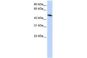 WB Suggested Anti-PDIA6 Antibody Titration: 0. (PDIA6 Antikörper  (Middle Region))