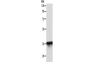 Gel: 10 % SDS-PAGE, Lysate: 40 μg, Lane: MCF7 cells, Primary antibody: ABIN7131160(SPATA2L Antibody) at dilution 1/500, Secondary antibody: Goat anti rabbit IgG at 1/8000 dilution, Exposure time: 30 seconds (SPATA2L Antikörper)