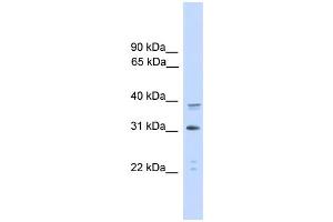 WB Suggested Anti-CEBPA Antibody Titration: 0. (CEBPA Antikörper  (C-Term))