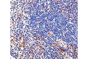 Immunohistochemistry (IHC) image for anti-V-Yes-1 Yamaguchi Sarcoma Viral Related Oncogene Homolog (LYN) (AA 229-263) antibody (ABIN3032775)