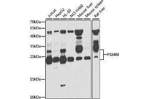 Western blot analysis of extracts of various cell lines, using PSMB8 antibody. (PSMB8 Antikörper)