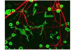 Immunostaining of cultured neurons and glia showing specific labeling of neuronal processes (red) using our alpha-internexin antibody and microglia (green) with a coronin 1a antibody.