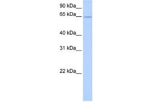 WB Suggested Anti-ZNF526 Antibody Titration:  0. (ZNF526 Antikörper  (C-Term))