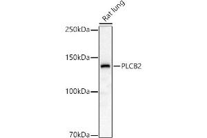 Western blot analysis of extracts of Rat lung, using PLCB2 antibody (ABIN6133052, ABIN6145747, ABIN6145748 and ABIN6224164) at 1:1000 dilution. (Phospholipase C beta 2 Antikörper  (AA 1-199))
