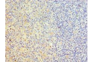 Immunohistochemistry of paraffin-embedded human tonsil tissue using ABIN7173837 at dilution of 1:100 (TNFRSF1D (AA 257-386) Antikörper)