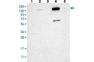 Western blot analysis of Lane 1: RT-4, Lane 2: U-251 MG, Lane 3: Human Plasma, Lane 4: Liver, Lane 5: Tonsil with ZNF629 polyclonal antibody  at 1:250-1:500 dilution. (Zinc Finger Protein 629 (ZNF629) Antikörper)