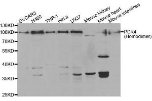 Western Blotting (WB) image for anti-Pyruvate Dehydrogenase Kinase, Isozyme 4 (PDK4) antibody (ABIN6220032) (PDK4 Antikörper)