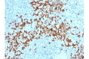 Immunohistochemistry (IHC) image for anti-Matrix Metallopeptidase 9 (Gelatinase B, 92kDa Gelatinase, 92kDa Type IV Collagenase) (MMP9) (AA 603-614) antibody (ABIN6940074)