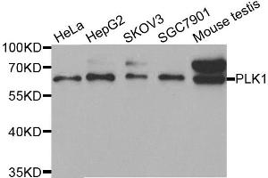 Western blot analysis of extracts of various cell lines, using PLK1 antibody. (PLK1 Antikörper)