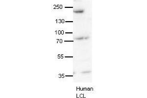 SYNJ1 antibody - N-terminal region  validated by WB using human LCL at 1:1000.