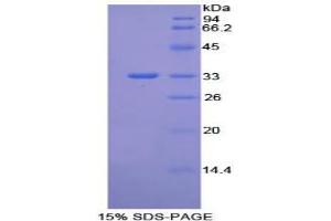 SDS-PAGE analysis of Mouse Integrin beta 1 Protein. (ITGB1 Protein)