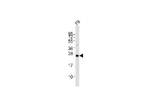 Anti-Lin28a Antibody (C-term)at 1:2000 dilution + F9 whole cell lysates Lysates/proteins at 20 μg per lane. (LIN28A Antikörper  (C-Term))